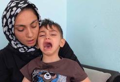 3,5 yaşındaki MLD hastası Miraç, konuşma yetisini de kaybetti