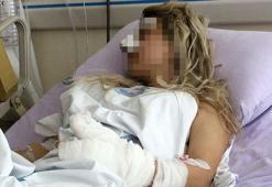 Sevgilisinin 2'nci kattan attığını iddia eden kadın: Yaşamam mucize
