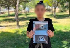 7 haftalık hamile kadından 'boş gebelik olabilir' raporu verildiğini öne sürdüğü hastane için suç duyurusu