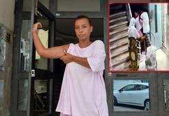 Gizem'i, babasıyla arazi anlaşmazlığı yaşayan amcası darbetti