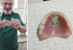Bursaspor’un fanatik taraftarı takma dişinin damağına da kulüp amblemi yaptırdı