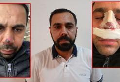Ameliyat sonrası burnunda iz oluştuğunu iddia edip, tedavi masrafı için hastaneye dava açtı