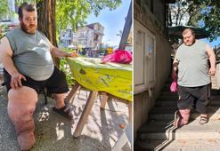 Fil hastası Kazım'ın tedavi olabilmesi için 82 kilo vermesi gerekiyor