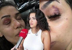 Bahçeşehir'de uzaklaştırma kararına rağmen evinin önünde darbedilen Ebru: Ölmeden önce sesimi duyun