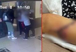 Özel okulda öğrencinin koluna kapı kolu saplandı, soruşturma başlatıldı
