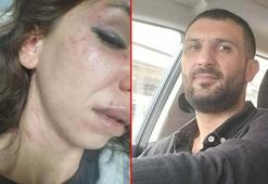 Eşinin boğazına bıçak dayayan sanığa 11,5 yıl hapis istemi