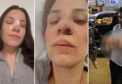 Eminönü'nde 2 kadını darbeden sanıkların yargılandığı duruşma 25 Şubat'a ertelendi: Davamın arkasındayım
