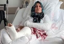 Kavgada 3 çocuk annesinin kolu ve bacağı kırıldı