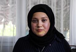 Tükürük bezi kanserini yenen Buse, okula yeniden döndü