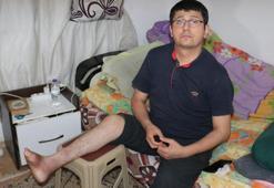 19 yıldır ayağındaki yaraya çare arıyor