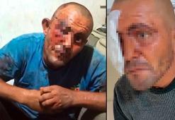 Sanal medyadaki videoları ile tanınan zihinsel engelli darbedildi