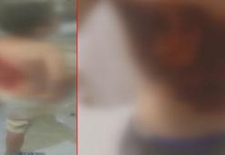 Arnavutköy’de arkadaşları tarafından kolonya dökülüp ateşe verilen 12 yaşındaki çocuk yaralandı