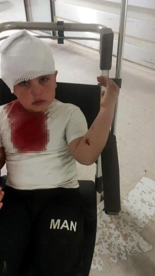 Sevmek istediği Pitbull melezi, hastanelik etti