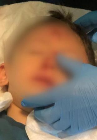 Eyüpsultanda kreşteki çocuk 2 metre yükseklikten inşaat alanına düştü