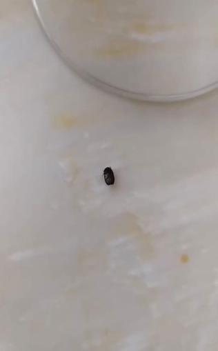 İzmit’te parkta 3 yaşındaki çocuğun kulağına kene yapıştı