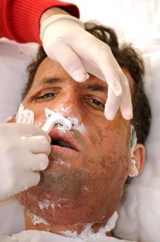 İlk yüz nakilli Uğur Acar, hayata 14 yıldır başka bir yüzle bakıyor