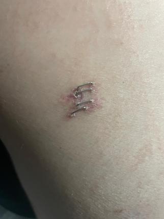 Bıçak ve sopayla girdiği kurs binasında öğrenciyi bıçakladı