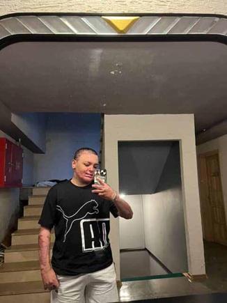 Kağıthane’de kuafördeki yangında vücudu yanan 15 yaşındaki Engin: Mücadeleyi kesinlikle bırakmasınlar ben yılmadım