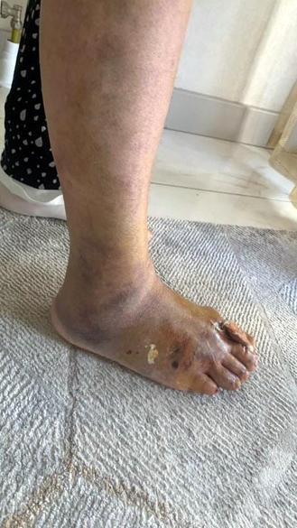 Avcılarda otomobil karşıdan karşıya geçmek isteyen kadının ayağını ezdi