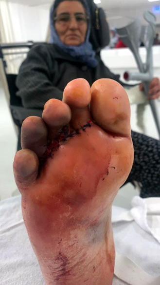 Avcılarda otomobil karşıdan karşıya geçmek isteyen kadının ayağını ezdi