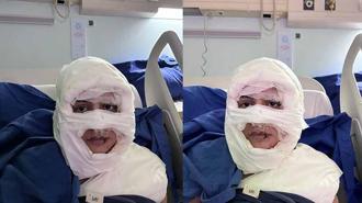 Kadıköy'de bir kadın, üzerine yanıcı madde dökülerek ateşe verildi