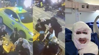 Kadıköy'de kadının üzerine yanıcı madde attıp kaçtı