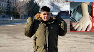 Otizmli öğrenciye darp iddiasına inceleme