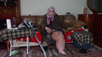 Fil hastalığıyla mücadele ederken oturduğu evin yıkılacağını öğrendi; 'Bacağım bu haldeyken nereye gideceğim'