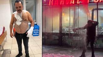 Soğuk havayı test etmek isterken kendini yaktı