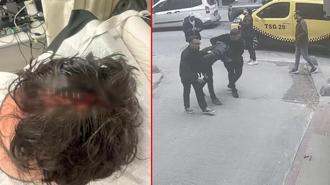 Beyoğlu’nda kaldırımda yürürken başına cam düştü; 7 dikiş atıldı