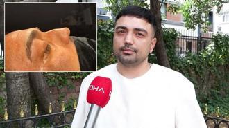 Horlama şikayetiyle 4 kez ameliyat oldu: Düzelmesi için daha kaç kere olmam gerek