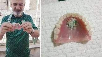 Bursaspor’un fanatik taraftarı takma dişinin damağına da kulüp amblemi yaptırdı