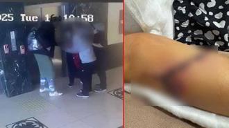 Özel okulda öğrencinin koluna kapı kolu saplandı, soruşturma başlatıldı