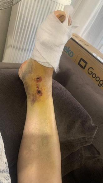 Avcılarda otomobil karşıdan karşıya geçmek isteyen kadının ayağını ezdi