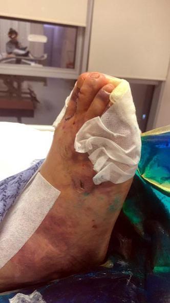 Avcılarda otomobil karşıdan karşıya geçmek isteyen kadının ayağını ezdi