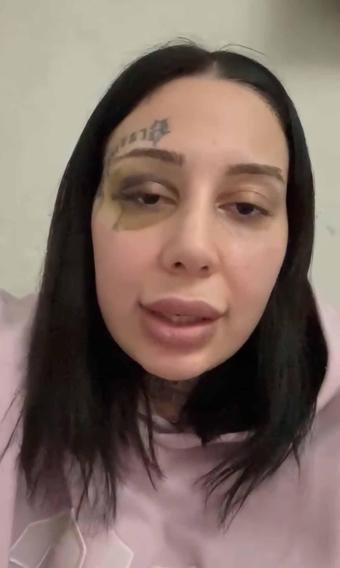 Kağıthane’de eşinin silah çekip darbettiği Yağmur: Hamile kaldım evlendik şiddet başladı