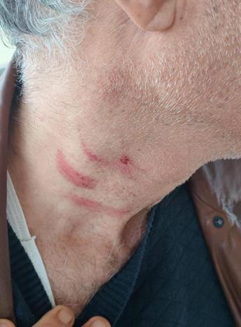 Müezzinin, sıra yüzünden aile hekimini darbettiği iddiası