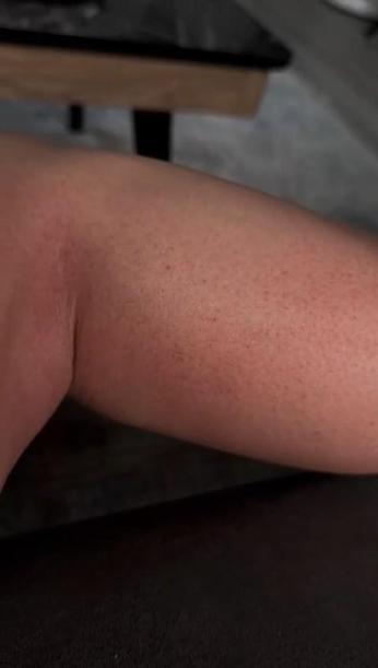 Solaryum cihazında unutulan Gülşah’tan mahkeme kararına tepki: Sağlık bu kadar ucuz olmamalı