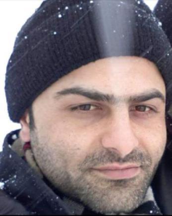 Lazer epilasyon sonrası yanık suçlaması