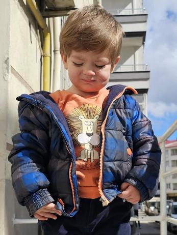 Pitbull saldırısında yaralanan kardeşlerin babası: Oğlumun yüzündeki yara kalıcı olacak gibi