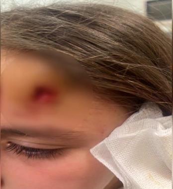 Beylikdüzünde skuter yayalara çarptı: 2 yaralı