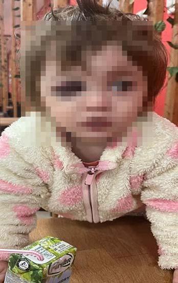 Kucağında bebeği ile darbedilen babanın oğlu, sokakta başına atılan taşla yaralandı