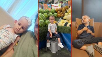 2,5 yaşındaki Nikoloz’un beyninden 7 santimetrelik tümör çıkarıldı