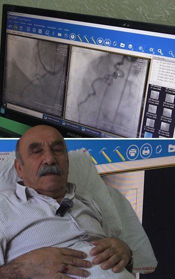 Hastanın kalbine giden kanı akciğere yönlendiren ‘anormal damar‘ operasyonla kapatıldı