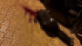 Sokakta yürürken tabanca ile başından vuruldu