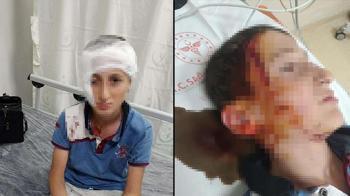11 yaşındaki çocuğa köpek saldırısında 1,2 milyon TL tazminat kararı
