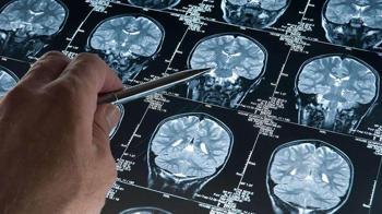 Araştırma: Derin uyku Alzheimer’ı yavaşlatıyor