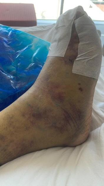 Avcılarda otomobil karşıdan karşıya geçmek isteyen kadının ayağını ezdi