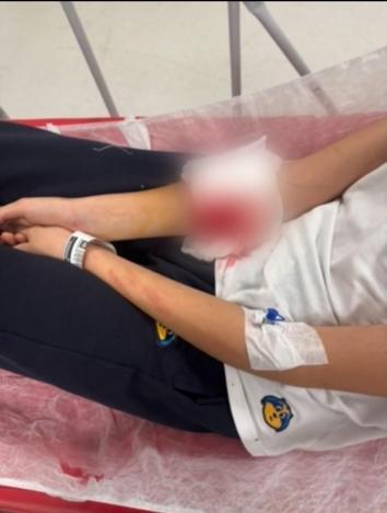 Özel okulda öğrencinin koluna kapı kolu saplandı, soruşturma başlatıldı