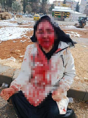 Boşanma aşamasındaki eşini kaldırım taşıyla ağır yaralayan şüpheli tutuklandı